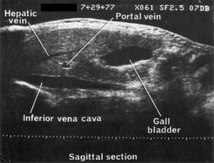 Scan - Obstetric and General