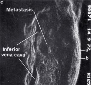 Scan - Obstetric and General