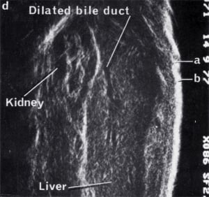 Scan - Obstetric and General