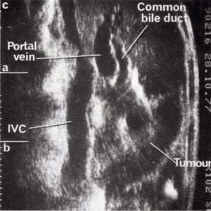 Scan - Obstetric and General