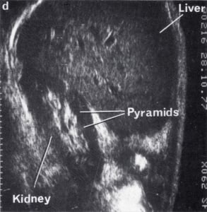 Scan - Obstetric and General