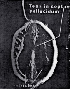 Scans - Paediatric
