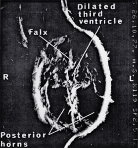 Scans - Paediatric