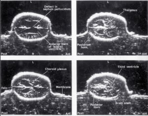 Scans - Paediatric