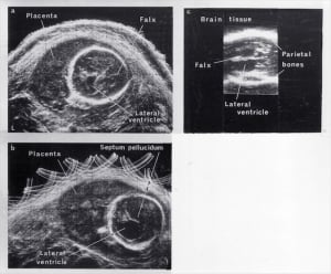 Scans - Paediatric