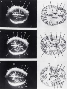 Scans - Paediatric