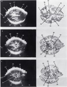 Scans - Paediatric
