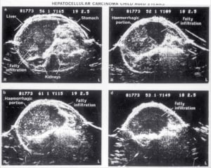 Scans - Paediatric
