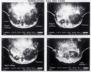 Scans - Paediatric
