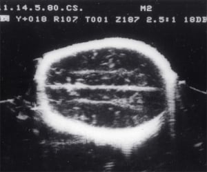 Scans - Paediatric