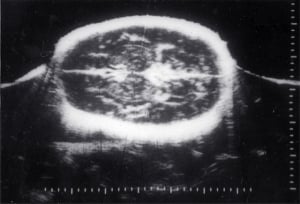 Scans - Paediatric