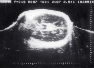 Scans - Paediatric