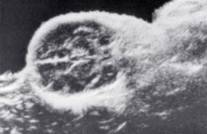 Scans - Paediatric