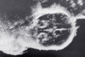 Scans - Paediatric