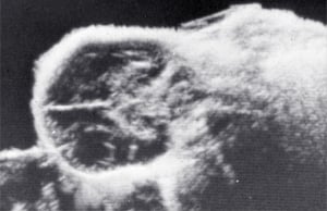 Scans - Paediatric