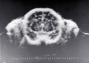 Scans - Paediatric