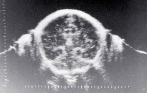 Scans - Paediatric