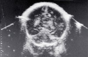 Scans - Paediatric