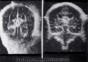 Scans - Paediatric