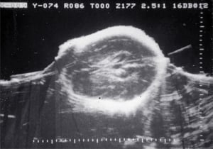 Scans - Paediatric