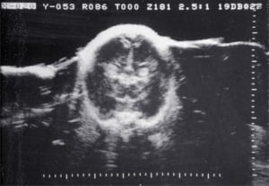 Scans - Paediatric
