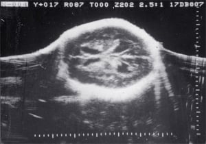 Scans - Paediatric