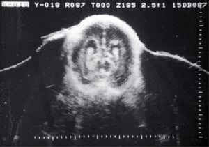 Scans - Paediatric