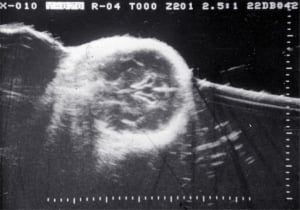 Twin I normal anatomy (1980)