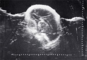 Twin I normal anatomy (1980)