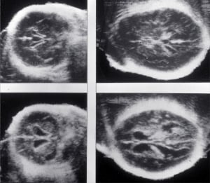 Scans - Paediatric