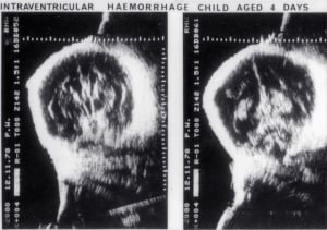 Scans - Paediatric