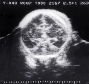 Scans - Paediatric