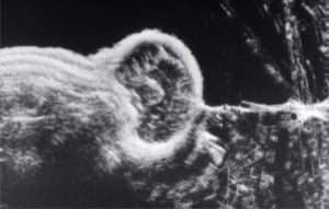 Scans - Paediatric