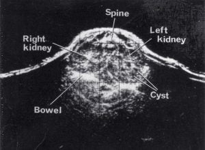 Scans - Paediatric