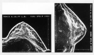 Ausonics Octoson images (1977)