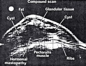 Scans - Breast
