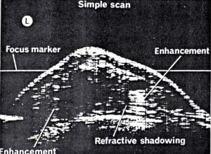 Scans - Breast