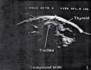 Scans - Scrotum & Thyroid