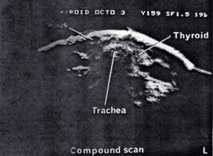 Scans - Scrotum & Thyroid