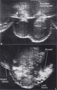 Scans - Scrotum & Thyroid
