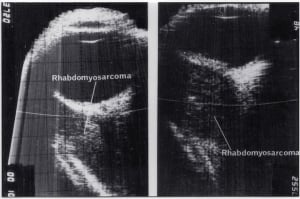 Scans - Eye