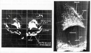 Scans - Eye