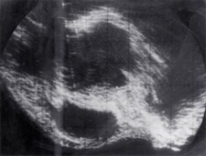 Scans - Eye