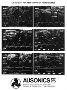 Ausonics Doppler