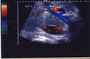 Scans - Doppler