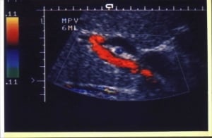 Scans - Doppler