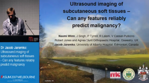 Ultrasound imaging of subcutaneous soft tissues – can any features reliably predict malignancy  - Dr Jacob Jaremko