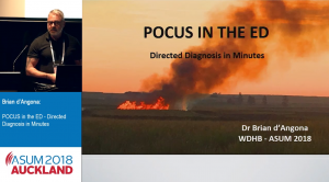 Cardiac case (POCUS in the ED - Directed diagnosis in Minutes) - Brian d'Angona