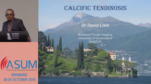 Calcific Tendinosis - Dr David lisle