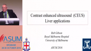 Contrast enhanced ultrasound (CEUS) Liver applications - Prof Robert Gibson